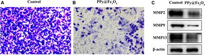 PPy@Fe3O4 Nanoparticles Inhibit Tumor Growth and Metastasis Through Chemodynamic and Photothermal Therapy in Non-small Cell Lung Cancer